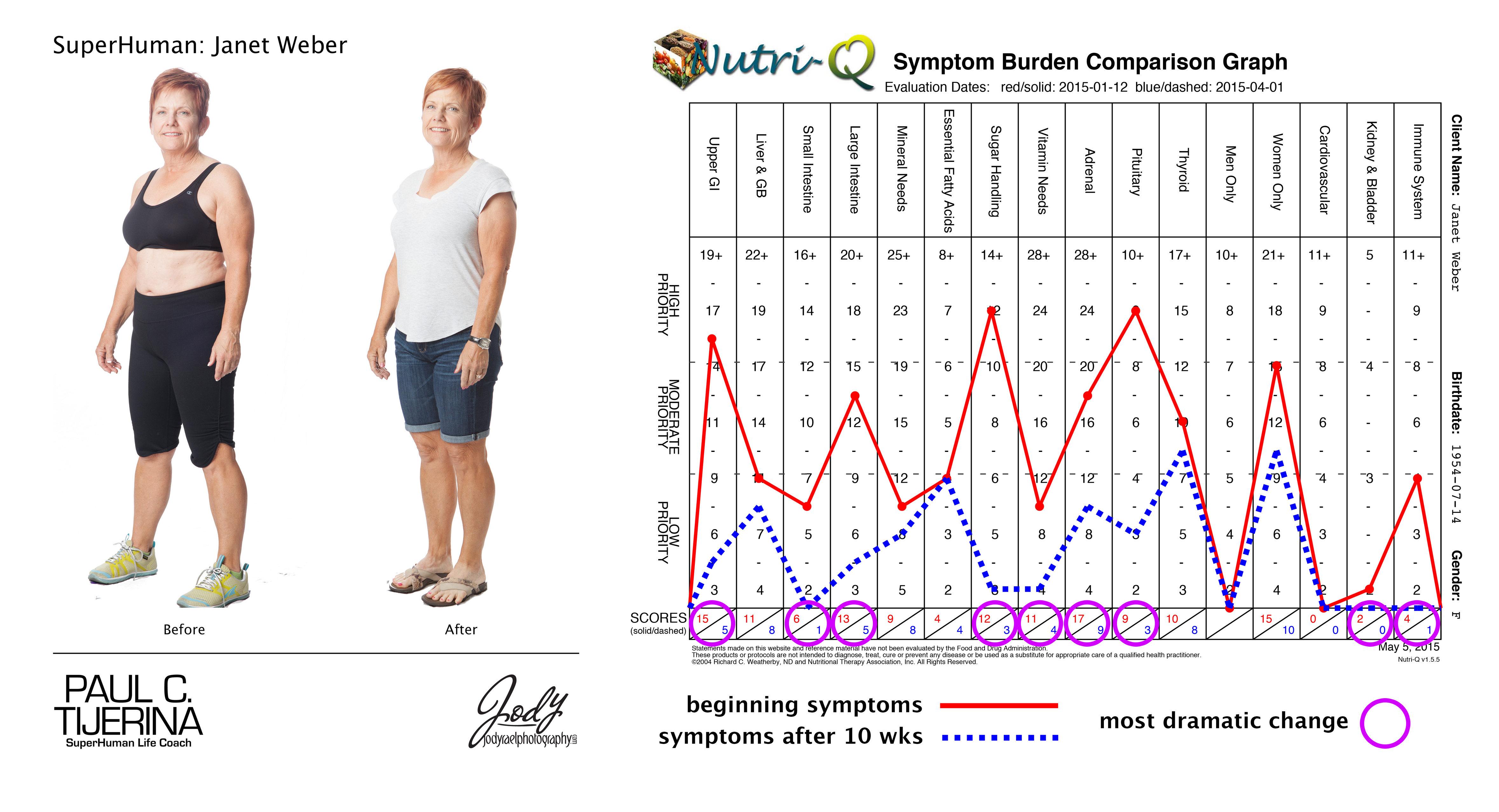 weber,-janet,-before-after-pics-symptom-graph